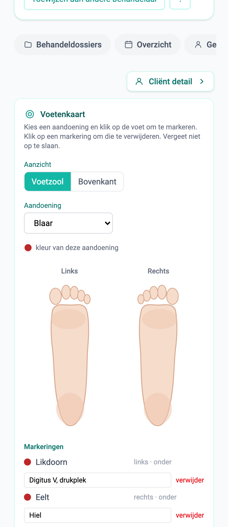 Voetenkaart (pedicure)
